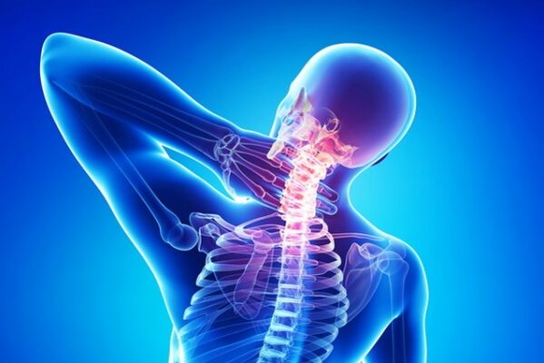 osteohondroze
