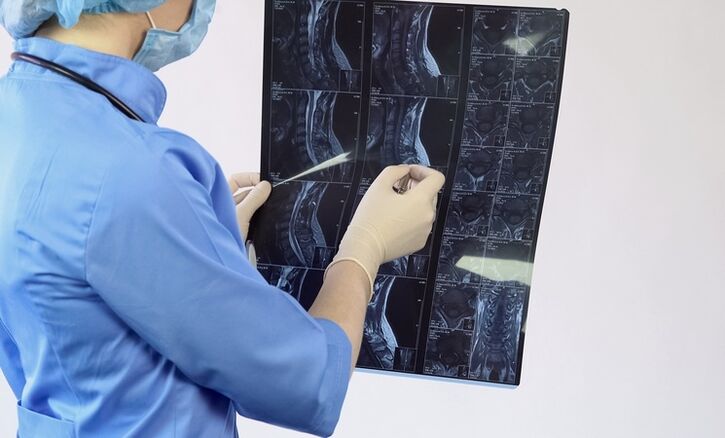 Dzemdes kakla osteohondrozes diagnoze tiek veikta, pamatojoties uz MRI pētījumu